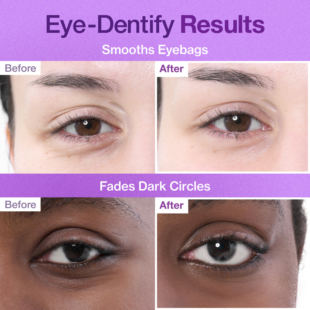 Numbuzin No.9 NAD+ Retinol Volumetox Eye Cream – 30ml