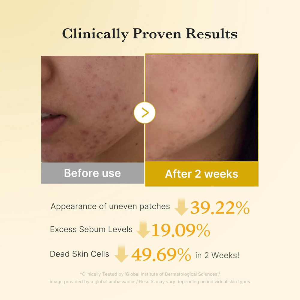 Medicube Kojic Acid Turmeric Pad With 3% Glycolic Acid – 160ml