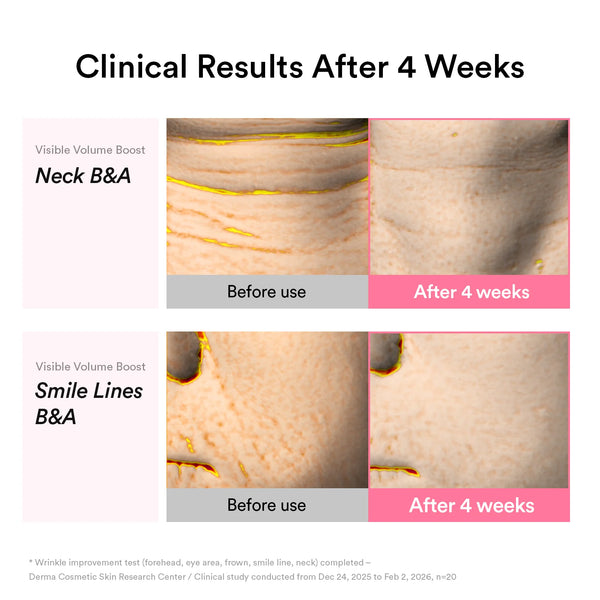 PDRN Volume Fill-It Booster Cream 2.5 – 30ml