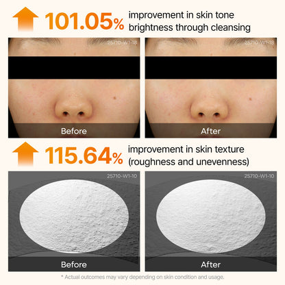 Dr.Melaxin Peel Shot Exfoliating Kojic Acid Turmeric Serum - 80ml