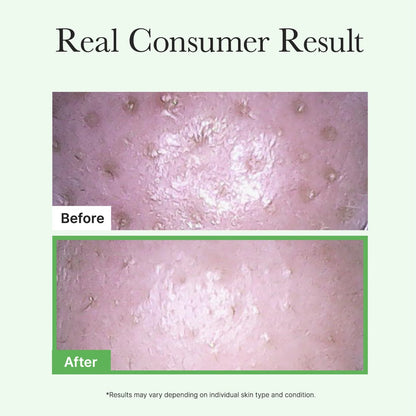 Arencia Pore Melt Mochi Cleansing Oil – 200ml