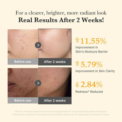 Medicube Kojic Acid Turmeric Niacinamide Serum – 30ml