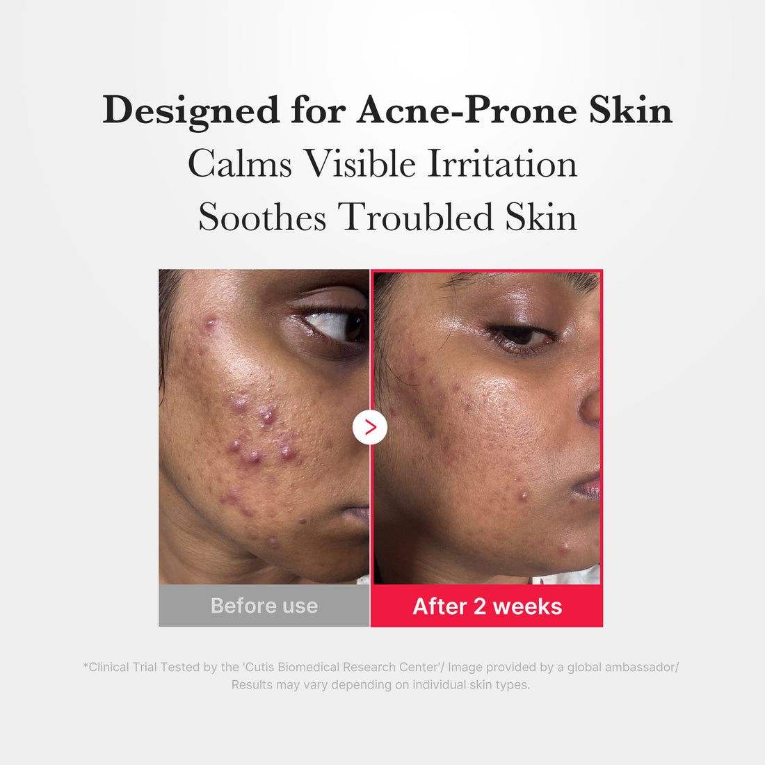 Medicube Hypochlorous Acid Daily Facial Spray – 125ml