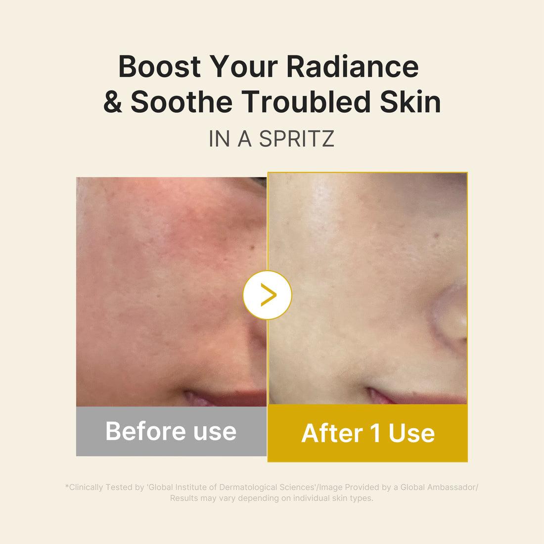 Medicube Kojic Acid Turmeric Vita Jelly Mist Serum - 100ml