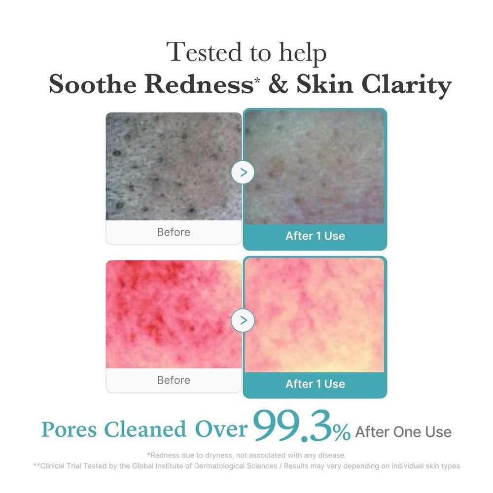 Medicube Azelaic acid Niacinamide Deep Clean Foam Cleanser - 120g