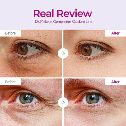 Dr.Melaxin Cemenrete Calcium Volume Eye Patch - 60 Patches