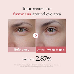 Medicube PDRN Pink Peptide Eye Cream – 30ml
