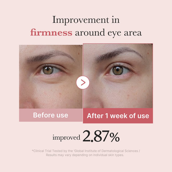 Medicube PDRN Pink Peptide Eye Cream – 30ml