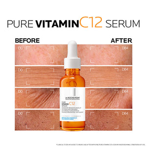 La Roche-Posay Pure Vitamin C10 Anti-Aging Serum – 30ml