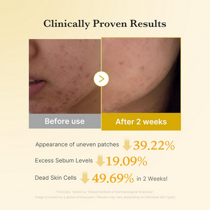 Medicube Kojic Acid Turmeric Pad With 3% Glycolic Acid – 160ml